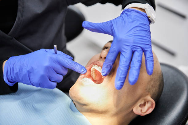 Best Emergency Wisdom Teeth Removal in Virden, IL